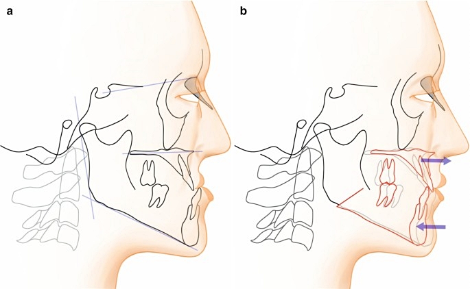 59e3b25d402caec91a26d7a5aa8f5b76_1761630508_4502.jpg 59e3b25d402caec91a26d7a5aa8f5b76_1761630508_4502.jpg