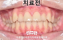 수술전