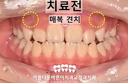 수술전