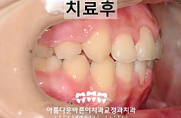 수술후