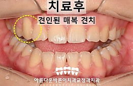수술후