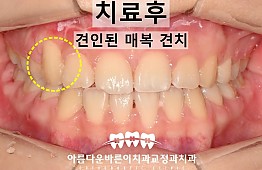 수술후