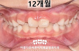 수술후