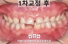 수술후