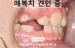 수술후