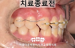 수술후