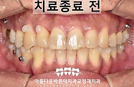 수술후
