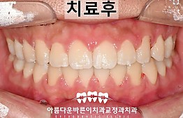 수술후