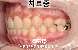 수술후