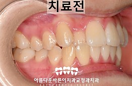 수술전