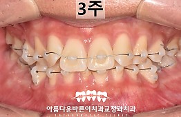 수술후
