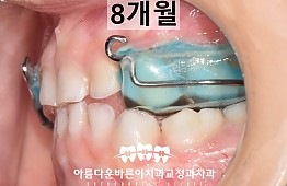 수술후