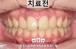 수술전