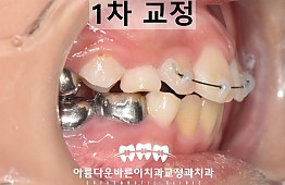 수술후