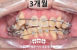 수술후