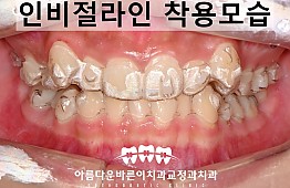 수술후