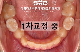 수술후