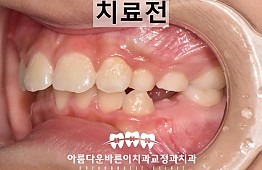 수술전