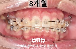 수술후