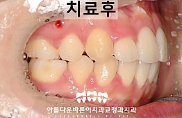 수술후