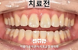 수술전