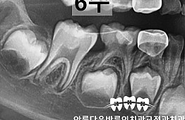 수술후