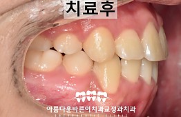 수술후