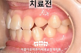 수술전