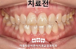 수술전