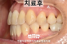 수술후