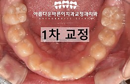 수술후