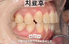 수술후