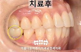 수술후
