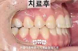 수술후
