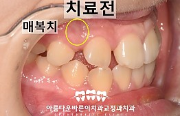 수술전