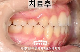 수술후