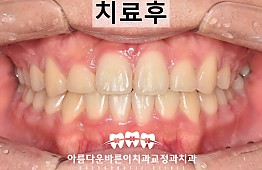 수술후