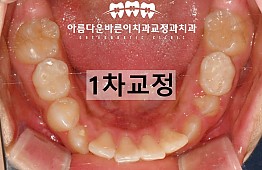 수술후