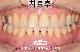 수술후