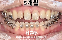 수술후