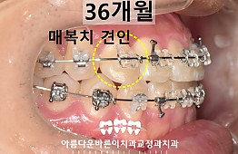 수술후