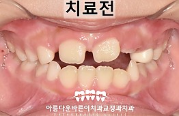 수술전