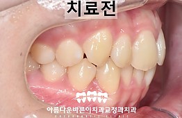 수술전