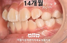 수술후