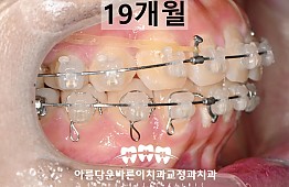수술후