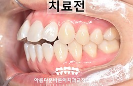 수술전