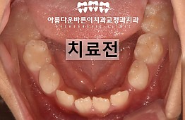 수술전