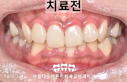 수술전