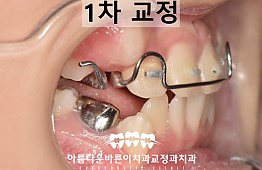 수술후