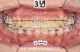 수술후
